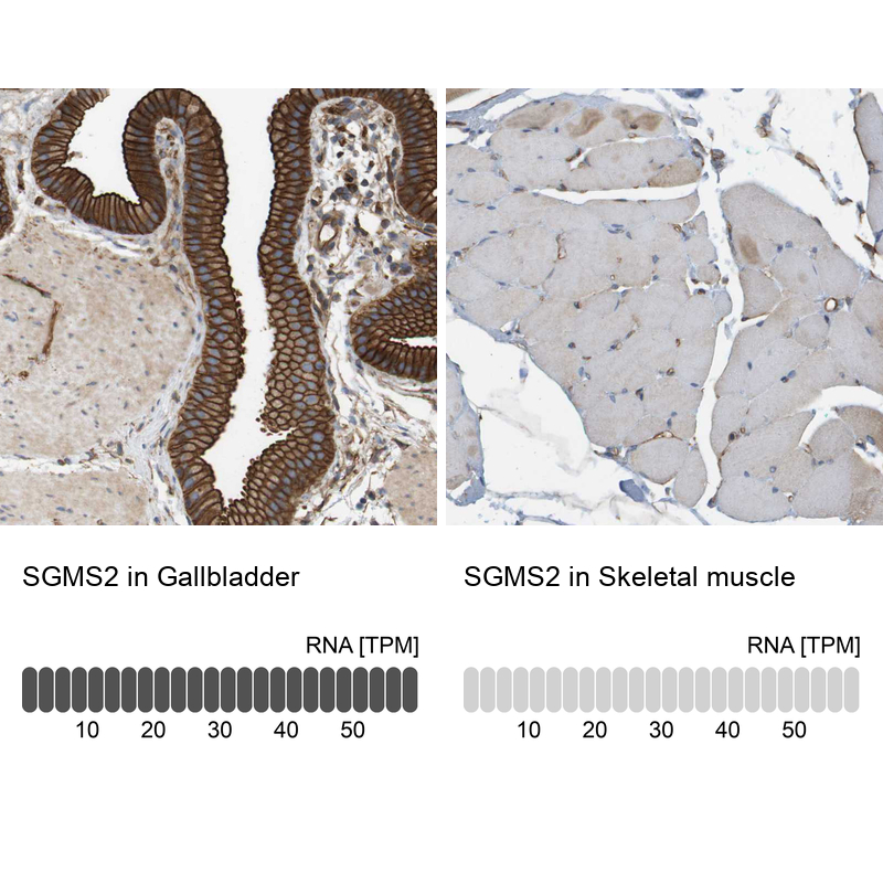 Anti-SGMS2 Antibody