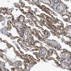 Immunohistochemical staining of human lung shows moderate membranous positivity in pneumocytes.