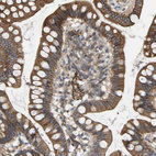 Immunohistochemical staining of human small intestine shows moderate membranous positivity in glandular cells.