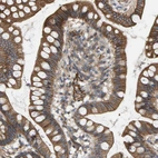 Immunohistochemical staining of human small intestine shows moderate membranous positivity in glandular cells.