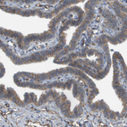 Immunohistochemical staining of human Fallopian tube shows weak membranous positivity in glandular cells.
