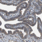 Immunohistochemical staining of human Fallopian tube shows weak membranous positivity in glandular cells.
