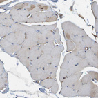 Immunohistochemical staining of human skeletal muscle shows weak positivity in myocytes.