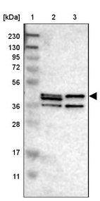 Lane 1: Marker [kDa] 230, 130, 95, 72, 56, 36, 28, 17, 11_br/_Lane 2: Human cell line RT-4_br/_Lane 3: Human cell line U-251MG sp