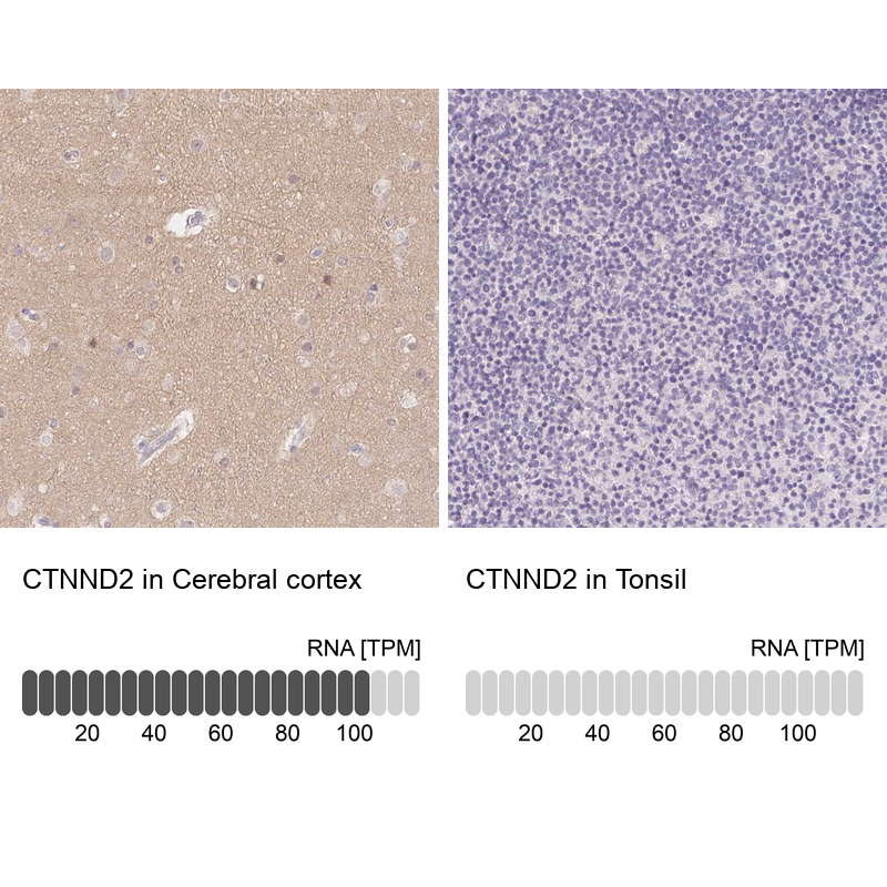 Anti-CTNND2 Antibody