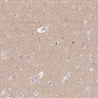 Immunohistochemical staining of human cerebral cortex shows weak positivity in neuropil.