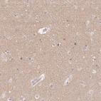 Immunohistochemical staining of human cerebral cortex shows weak positivity in neuropil.