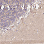 Immunohistochemical staining of human cerebellum shows weak cytoplasmic positivity in Purkinje cells.