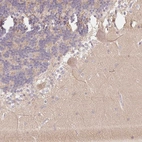 Immunohistochemical staining of human cerebellum shows weak cytoplasmic positivity in Purkinje cells.