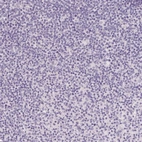 Immunohistochemical staining of human tonsil shows no positivity in germinal center cells as expected.