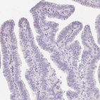 Immunohistochemical staining of human fallopian tube shows no positivity in glandular cells as expected.