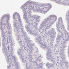 Anti-CTNND2 Antibody