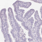 Immunohistochemical staining of human fallopian tube shows no positivity in glandular cells as expected.