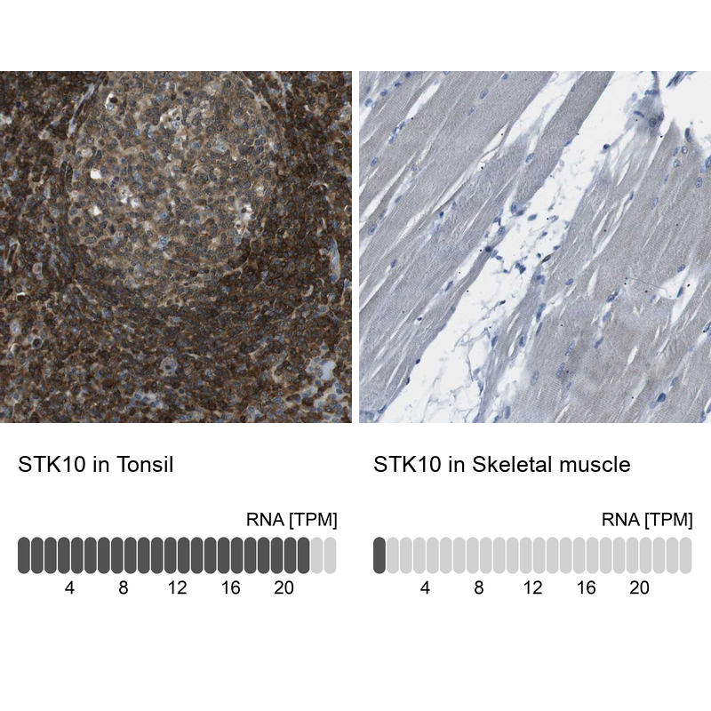 Anti-STK10 Antibody