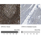 Anti-STK10 Antibody