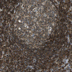 Immunohistochemical staining of human tonsil shows strong membranous positivity in non-germinal center cells.