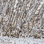 Immunohistochemical staining of human rectum shows strong membranous positivity in lymphoid cells.