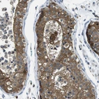 Immunohistochemical staining of human testis shows moderate cytoplasmic positivity in cells in seminiferous ducts.