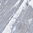 Immunohistochemical staining of human skeletal muscle shows no positivity in myocytes as expected.