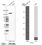 Western blot analysis in human cell lines SK-MEL-30 and HeLa using Anti-STK10 antibody. Corresponding STK10 RNA-seq data are presented for the same cell lines. Loading control: Anti-COX4I1.