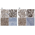 Immunohistochemical staining of human gastrointestinal, kidney, liver and lymph node using Anti-MARC2 antibody HPA015085 (A) shows similar protein distribution across tissues to independent antibody HPA017572 (B).