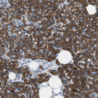 Immunohistochemical staining of human Parathyroid gland shows strong granular cytoplasmic positivity in glandular cells.