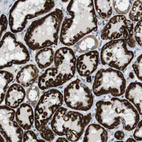 Immunohistochemical staining of human Kidney shows strong granular cytoplasmic positivity in cells in tubules.