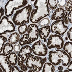 Immunohistochemical staining of human Kidney shows strong granular cytoplasmic positivity in cells in tubules.