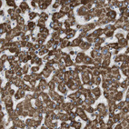 Immunohistochemical staining of human Liver shows strong granular cytoplasmic positivity in hepatocytes.