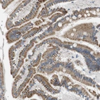 Immunohistochemical staining of human Duodenum shows moderate granular cytoplasmic positivity in glandular cells.