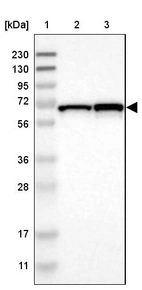 Lane 1: Marker [kDa] 230, 130, 95, 72, 56, 36, 28, 17, 11_br/_Lane 2: Human cell line RT-4_br/_Lane 3: Human cell line U-251MG sp