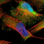 Immunofluorescent staining of human cell line U-251 MG shows localization to cytosol.