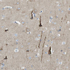 Immunohistochemical staining of human cerebral cortex shows strong cytoplasmic positivity in a subset of neuronal cells.