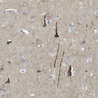 Immunohistochemical staining of human cerebral cortex shows strong cytoplasmic positivity in a subset of neuronal cells.