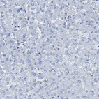 Immunohistochemical staining of human liver shows no positivity in hepatocytes as expected.