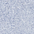 Immunohistochemical staining of human liver shows no positivity in hepatocytes as expected.