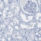 Immunohistochemical staining of human kidney shows no positivity in cells in tubules as expected.