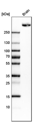 Western blot analysis in human brain tissue.