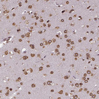 Anti-MTDH Antibody