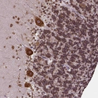 Immunohistochemical staining of human cerebellum shows moderate to strong cytoplasmic positivity in purkinje cells.