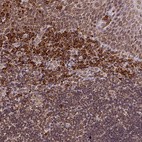 Immunohistochemical staining of human tonsil shows moderate to strong cytoplasmic positivity in non - germinal center cells.