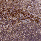 Anti-MTDH Antibody