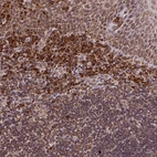 Immunohistochemical staining of human tonsil shows moderate to strong cytoplasmic positivity in non - germinal center cells.