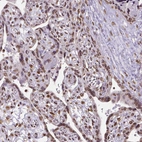Immunohistochemical staining of human placenta shows moderate to strong cytoplasmic positivity in decidual cells.