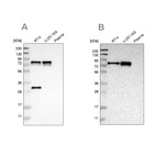 Western blot analysis using Anti-MTDH antibody HPA015104 (A) shows similar pattern to independent antibody HPA010932 (B).