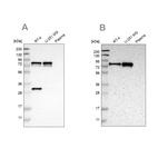 Anti-MTDH Antibody