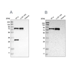 Western blot analysis using Anti-MTDH antibody HPA015104 (A) shows similar pattern to independent antibody HPA010932 (B).
