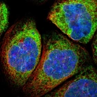Immunofluorescent staining of human cell line A-431 shows localization to endoplasmic reticulum.