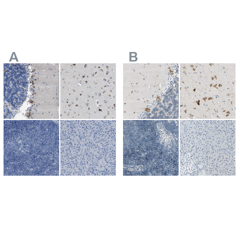 Anti-B4GALNT1 Antibody