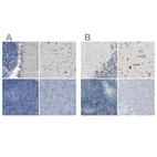 Anti-B4GALNT1 Antibody